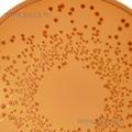 Sorbitol MacConkey Agar