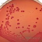 MacConkey Agar (without salt)