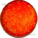 Listeria Monocytogenes Blood Agar (LMBA)